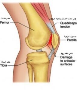 شكل صابونة الركبة