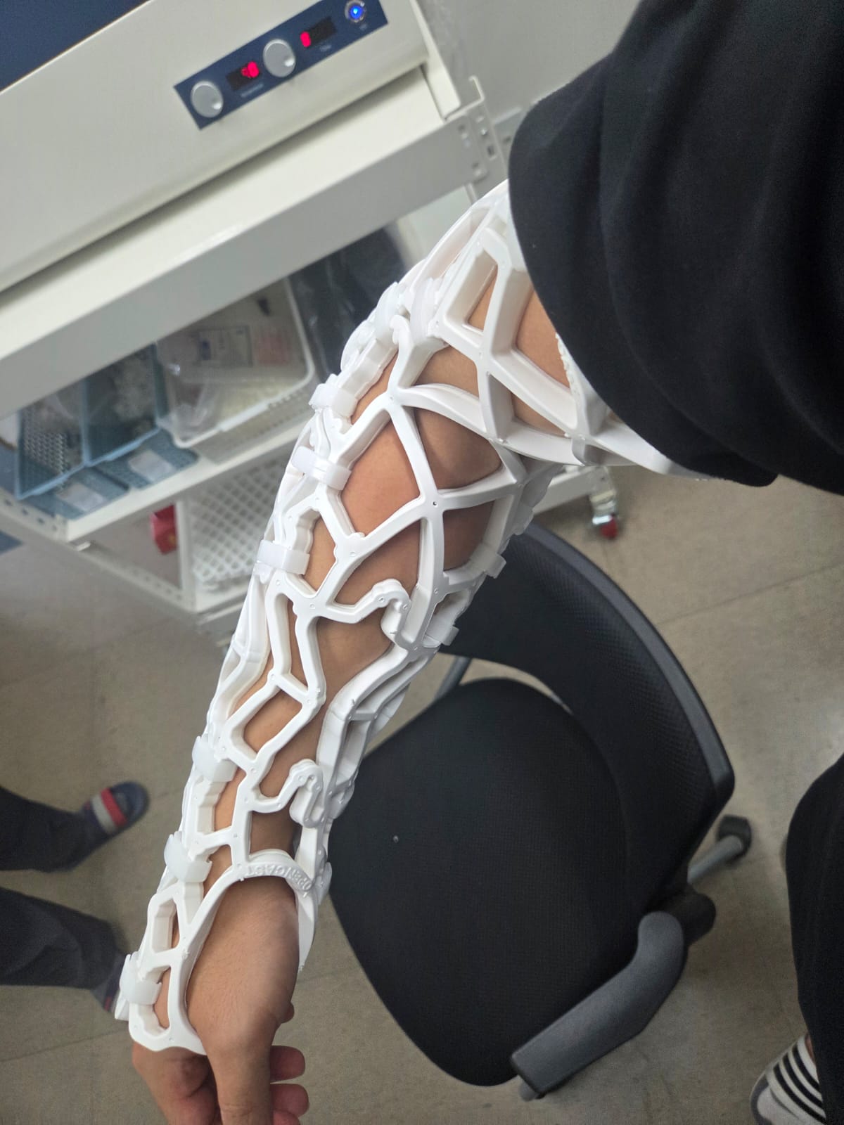 جبيرة open cast للذراع