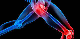 الألم المحال